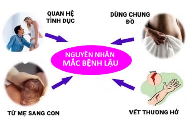 NGUYÊN NHÂN GÂY BỆNH LẬU Ở NỮ GIỚI