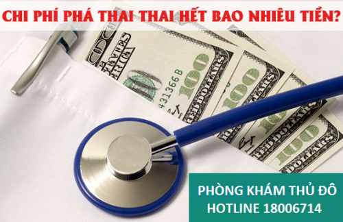 Chi phí cho 1 ca phá thai hết bao nhiêu?