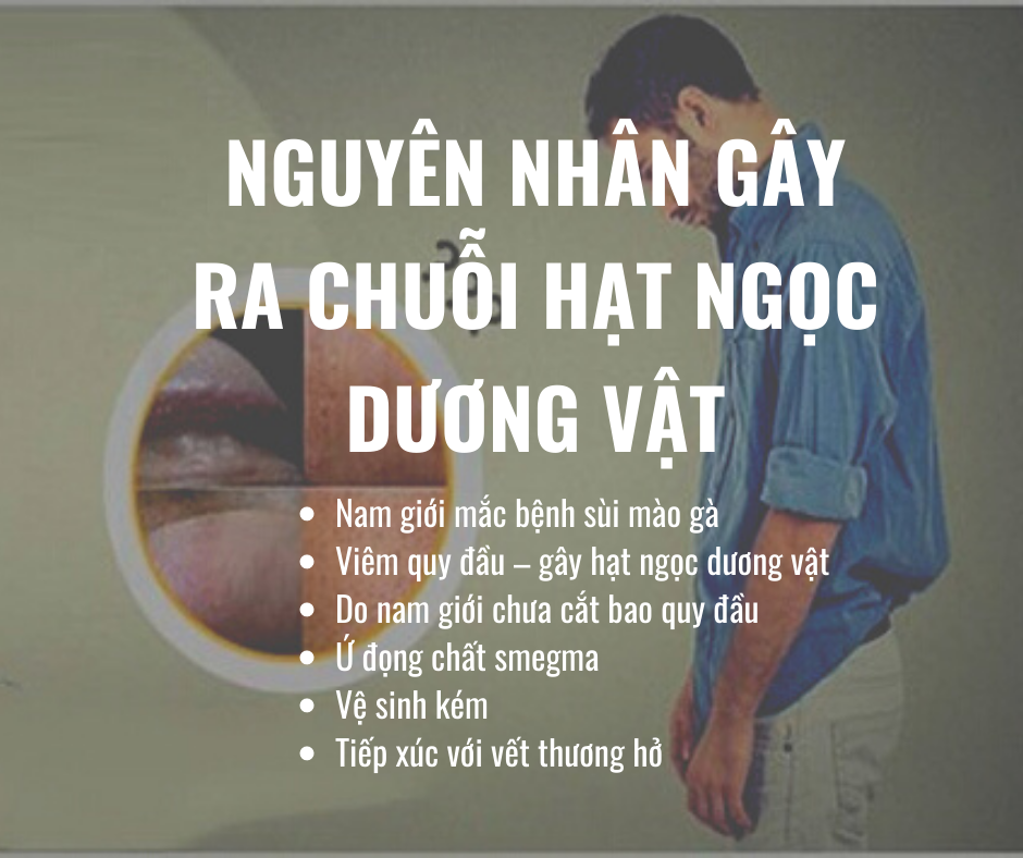 Nguyên nhân gây ra chuỗi hạt ngọc dương vật