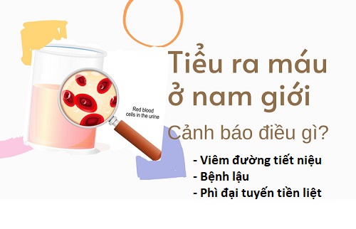 TIỂU RA MÁU THỰC CHẤT LÀ BỊ LÀM SAO?