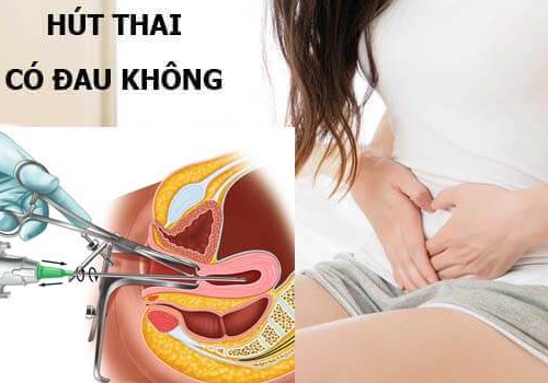 Giải đáp thắc mắc: Hút thai có đau không?