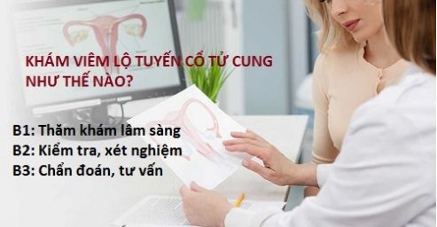 TÌM HIỂU VỀ KHÁM VIÊM LỘ TUYẾN CỔ TỬ CUNG