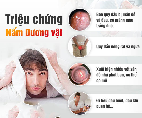 TÌM HIỂU VỀ DẤU HIỆU CỦA BỆNH NẤM BAO QUY ĐẦU