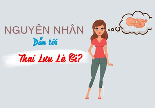 Nguyên nhân dẫn đến thai lưu