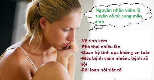 NGUYÊN NHÂN KHIẾN CHỊ EM BỊ MẮC BỆNH VIÊM LỘ TUYẾN CỔ TỬ CUNG.