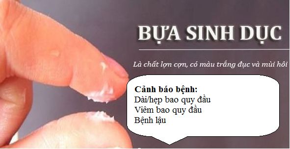 BỰA SINH DỤC LÀ GÌ?