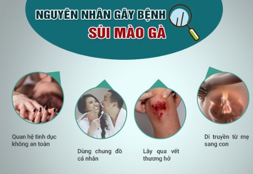 NGUYÊN NHÂN BỊ SÙI MÀO GÀ Ở VÙNG KÍN