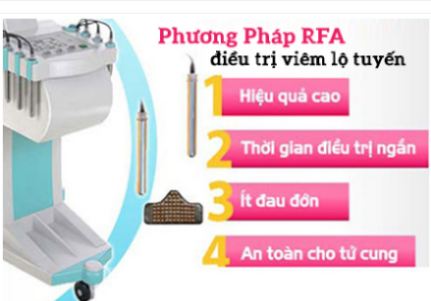 MÁCH NHỎ: CÁCH CHỮA BỆNH VIÊM LỘ TUYẾN CỔ TỬ CUNG