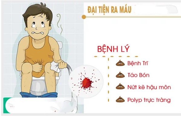 MÁCH NHỎ: CÁCH CHỮA ĐẠI TIỆN RA MÁU