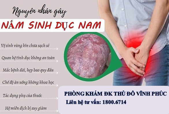 NGỨA BỘ PHẬN SINH DỤC: NGUYÊN NHÂN VÀ CÁCH ĐIỀU TRỊ