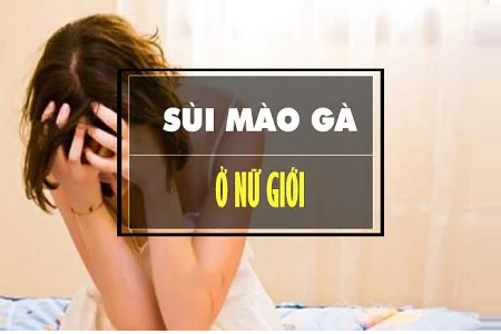 Sùi mào gà ở nữ giới