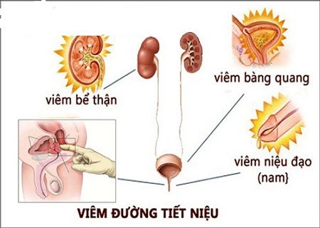 MÁCH NHỎ: CÁCH KHẮC PHỤC TÌNH TRẠNG ĐÁI RẮT