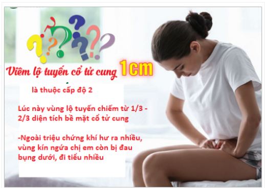 CÁCH XÁC ĐỊNH CẤP ĐỘ VIÊM LỘ TUYẾN CHI TIẾT