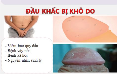 ĐẦU KHẤC BỊ KHÔ RÁT