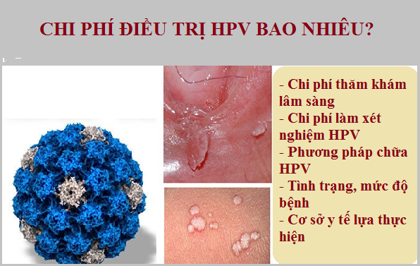 Bạn có biết: chữa HPV hết bao nhiêu tiền